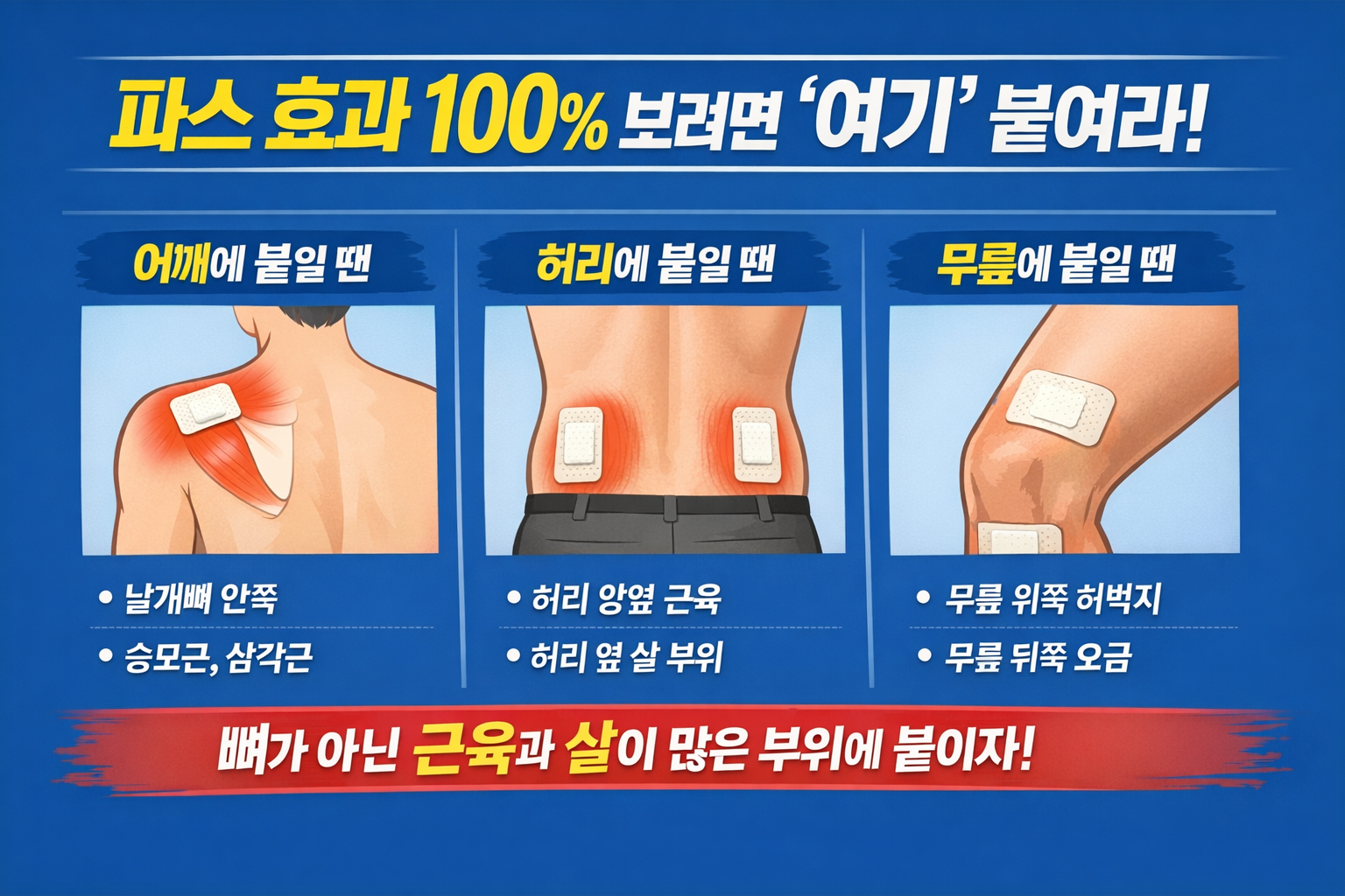 파스 붙이는 법, 아픈 뼈 말고 근육에 붙여야 효과 봅니다