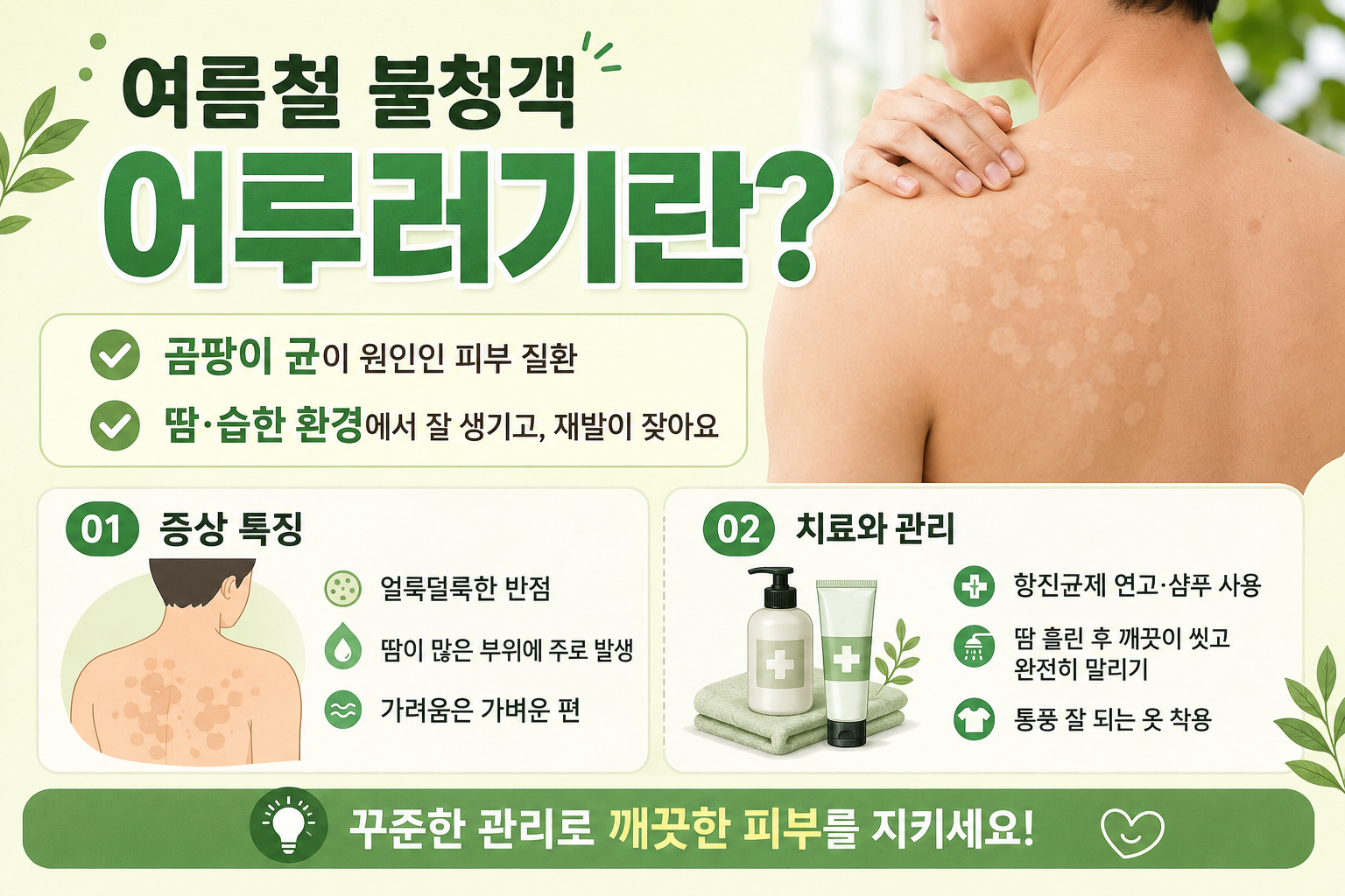 어루러기 증상 여름철 피부 반점이라면? 원인부터 항진균제 치료·재발 예방법