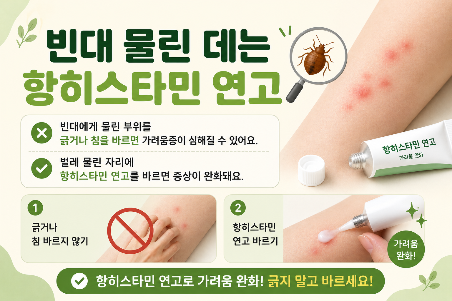 빈대 물린 자국 가려움, 항히스타민 연고로 완화하는 법