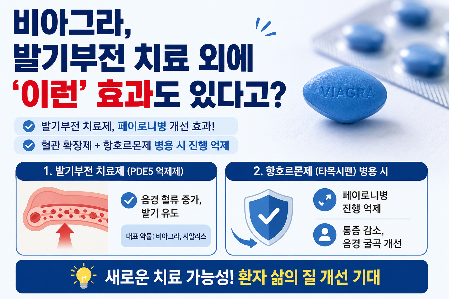 비아그라 뜻밖의 효과, 발기부전 넘어 페이로니병 개선 가능성까지?