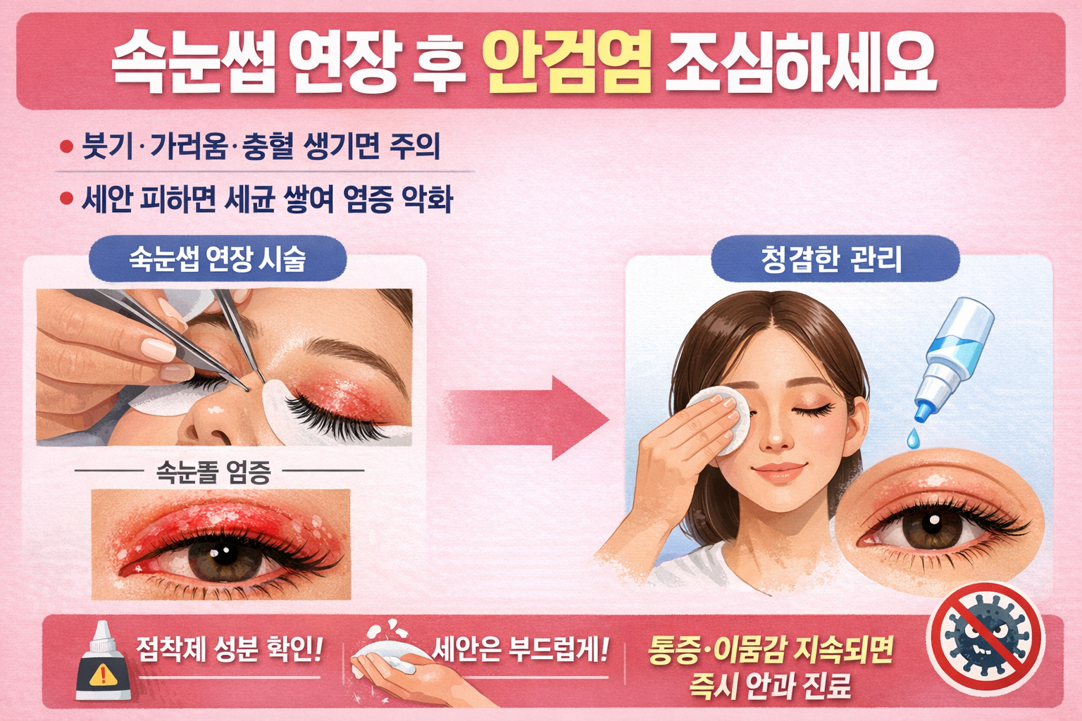 속눈썹 연장 후 눈이 가렵다면? 안검염 부르는 부작용 총정리