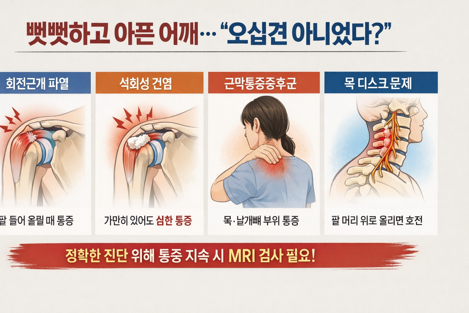 어깨 아픈데 오십견 아니었다? 회전근개 파열·목디스크 구별법