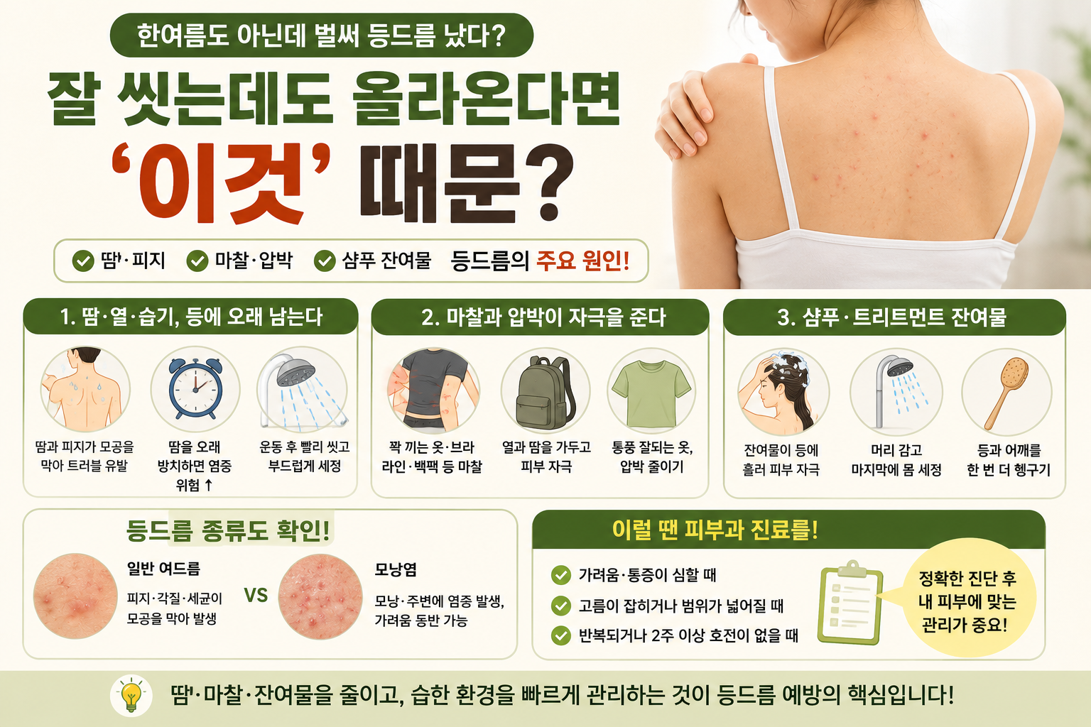 잘 씻는데도 등드름 난다면? 샴푸 잔여물과 옷 마찰이 원인일 수 있다